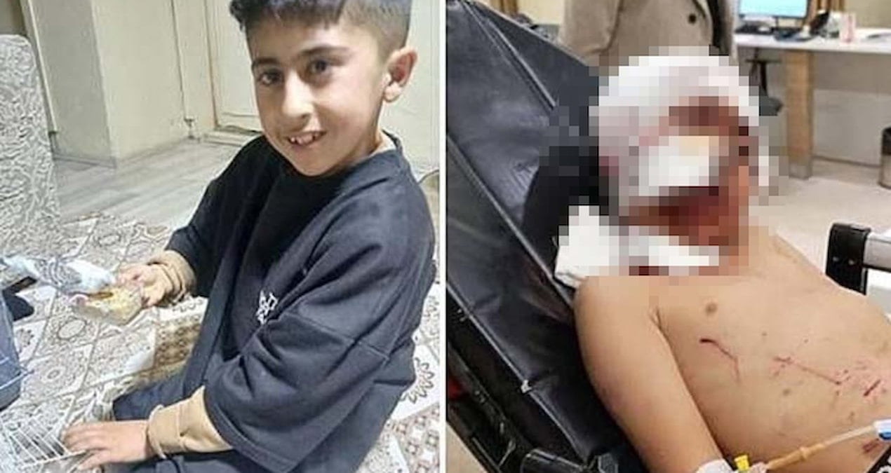 Köpeklerin saldırısına uğrayan küçük Murat, ağır yaralandı