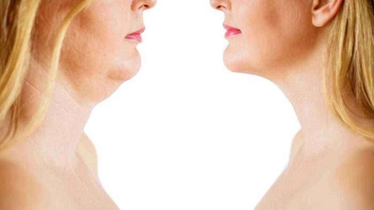 Cilt sarkmalarını önlemek için bu alışkanlıkları edinmeliyiz?