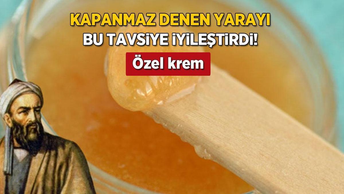 Kapanmaz yaraları kapayan İbn-i Sina kremi! 2 günde etki ediyor, gücü doğal