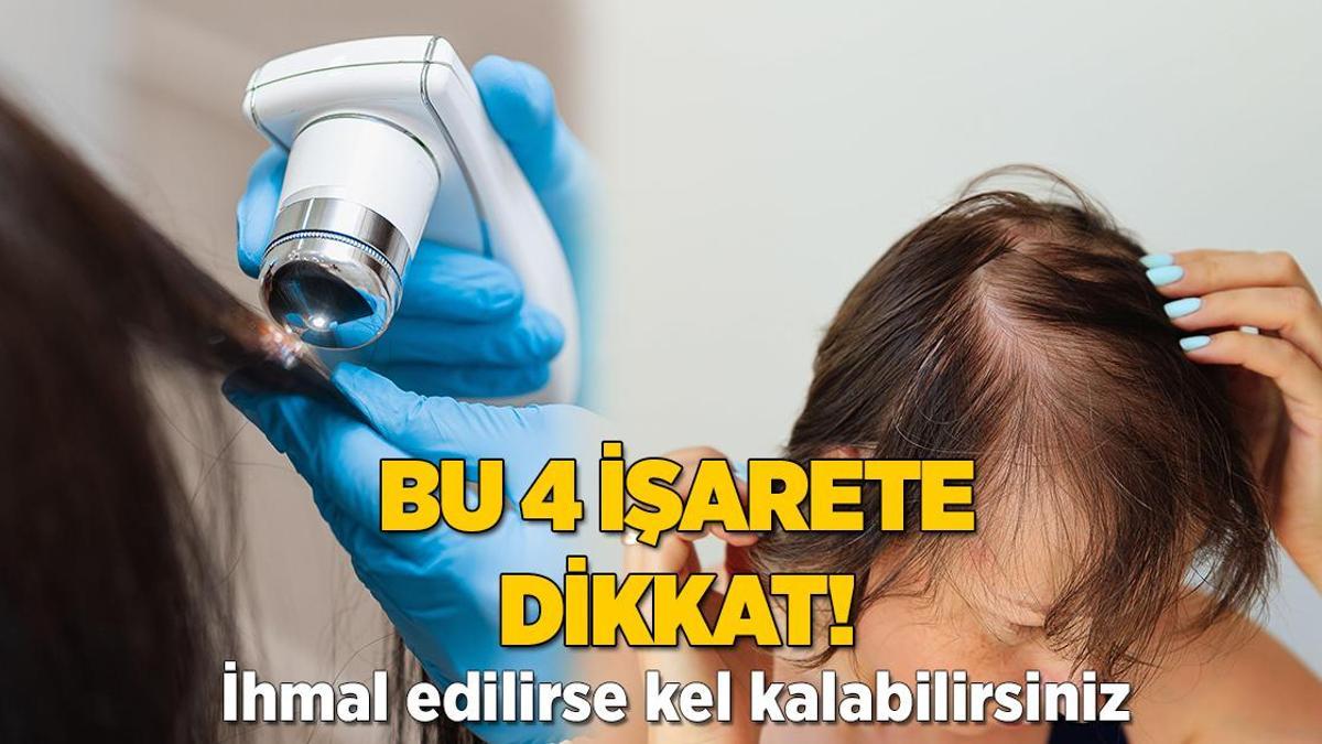 Tarağınıza iyice bakın, 4 işareti var! İhmal edilirse kel kalabilirsiniz